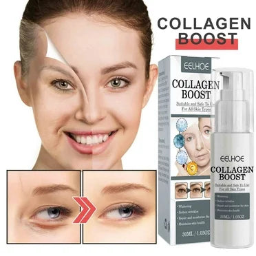COLLAGEN BOST